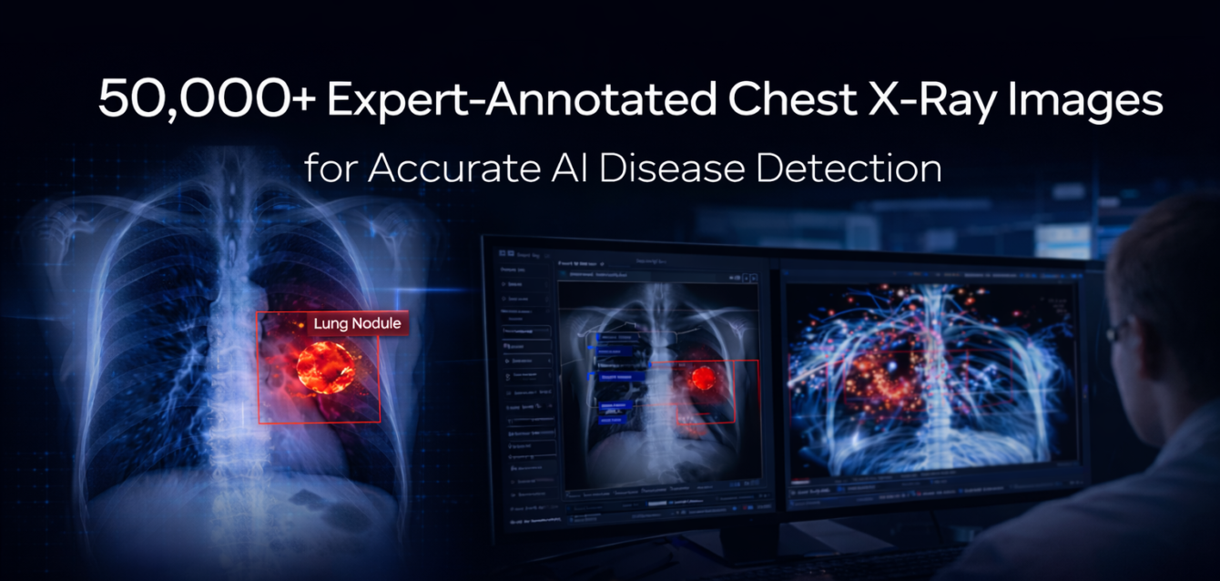 lung x-ray annotation for ai diagnostics lung x-ray annotation for ai diagnostics